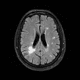 MS Lesion Segmentation Research Logo